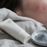 Crème visage zinc PCA sur peau avec rougeurs apaisées et sébum régulé