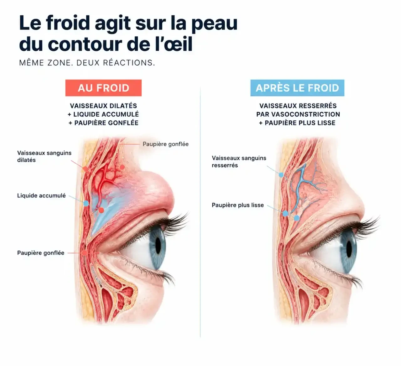 Schéma de l'effet du masque froid visage sur les vaisseaux : vasoconstriction et atténuation temporaire des poches